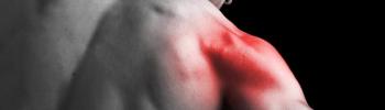 Diferentes tipos de masajes utilizados para eliminar el dolor causado por los Puntos de Gatillo Diferentes tipos de masajes utilizados para eliminar el dolor causado por los Puntos de Gatillo