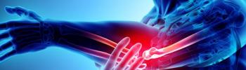 Tratamiento de Ondas de Choque como método para tratar las Calcificaciones
