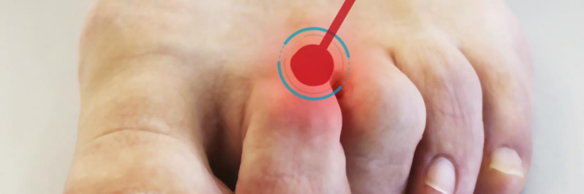 Rasgos distintivos de los Dedos en Garra y cuales son sus posibles causas