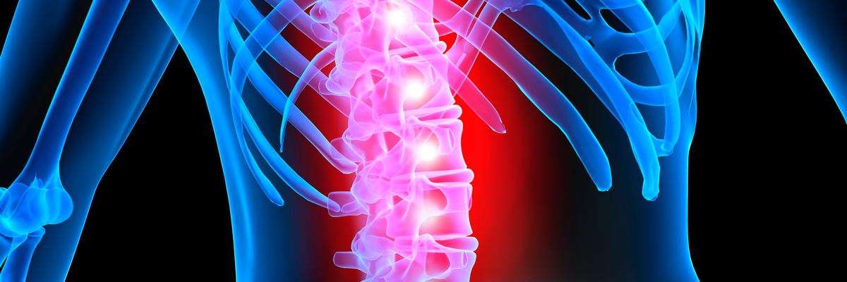 Principales secuelas de las Lesiones Medulares y en que consiste su rehabilitación