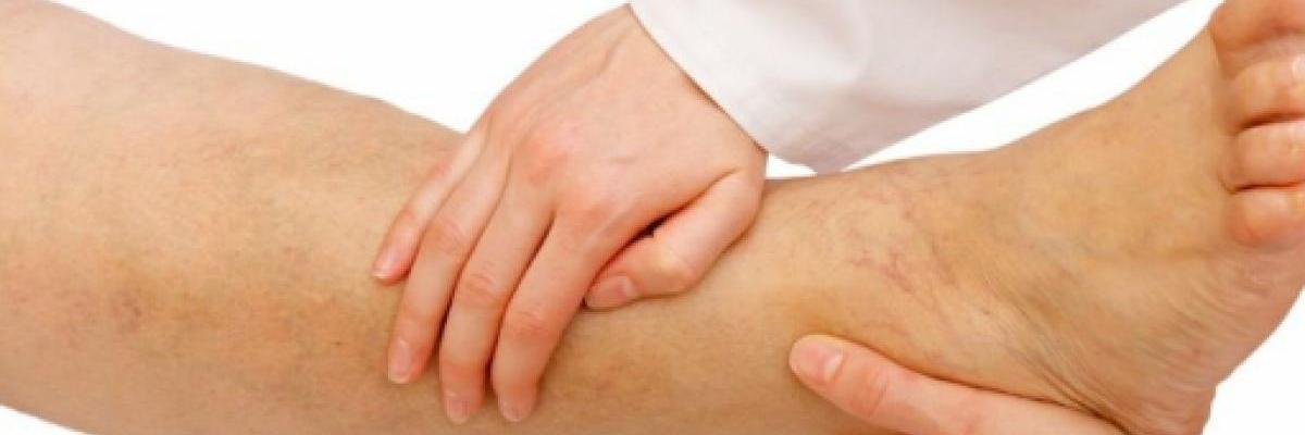 Principales desencadenantes de la retención de líquidos y cual es su tratamiento en FisioClinics Madrid 